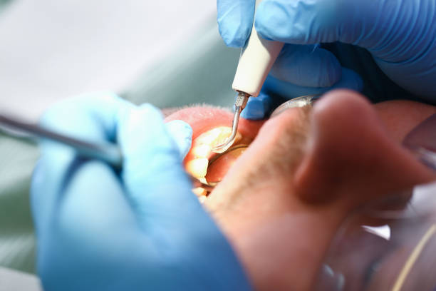 Best Pediatric Emergency Dentist in Westport, IN