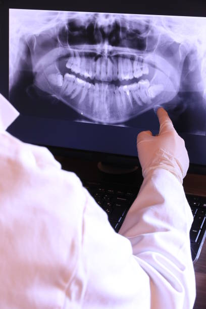 Best Emergency Dental Extractions in Westport, IN