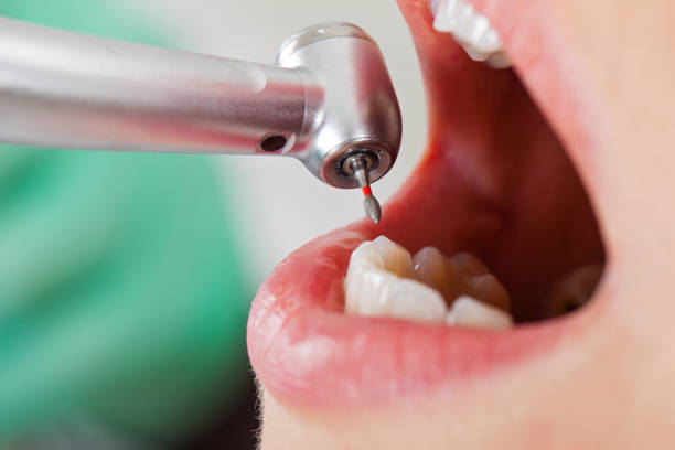 Best Mobile Emergency Dentist in Westport, IN